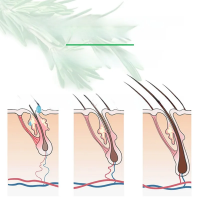 Grenz berschreiten des hei es kr uter haar l haarpflege fl ssiges haar wachstum dichtes haar rosmarin reparatur dichtes haar therisches l haarpflege therisches l 2